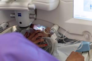 Công d'applanation du laser Visumax de Zeiss appliqué sur l'oeil du patient au bloc opératoire.