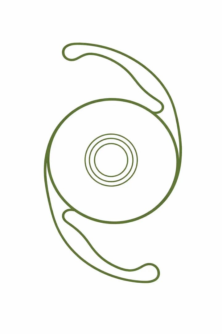 Implant EDOF utilisé en chirurgie de la cataracte pour une vision continue avec profondeur de champ étendue