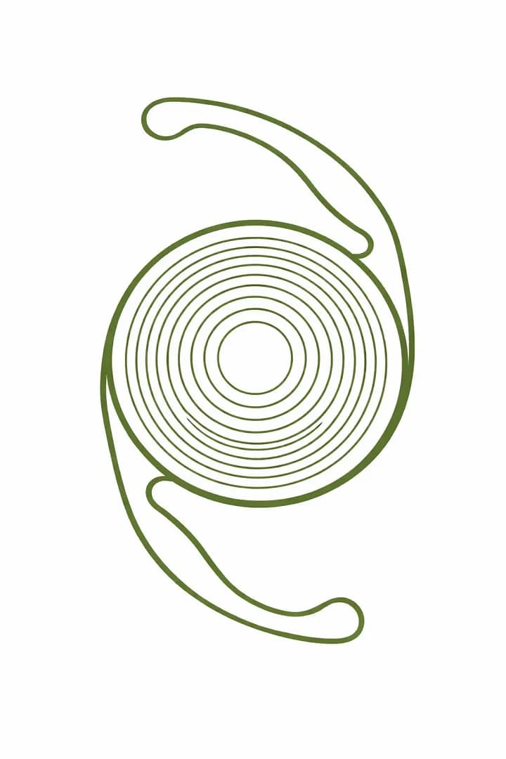 Implant multifocal utilisé en chirurgie de la cataracte pour la vision de loin et de près